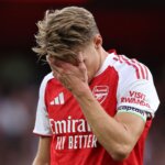 Odegaard Injury Rocks Arsenal as Captain Forced Off Against Leeds 2 GettyImages 2228858131
