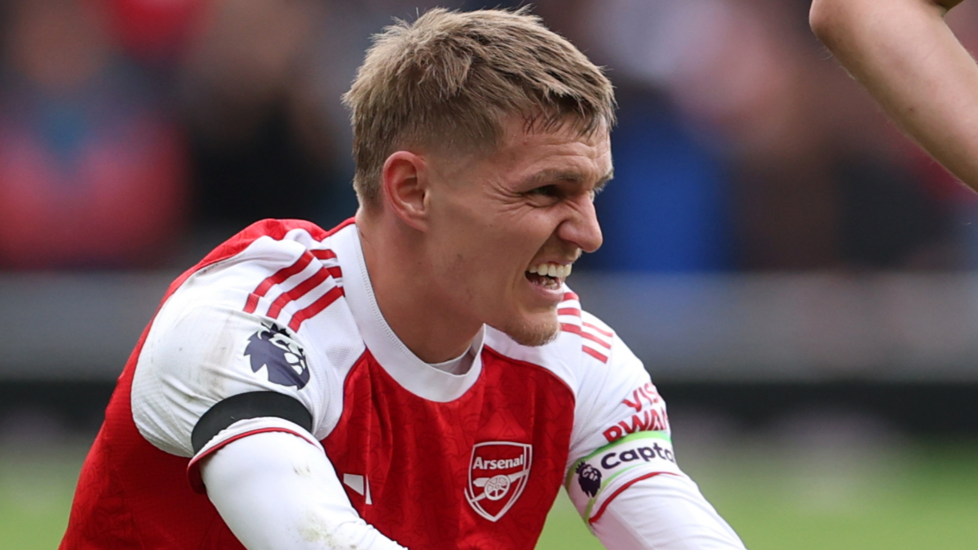 Odegaard Injury Update Raises Concerns for Arsenal 5 GOAL20 20Blank20WEB20 20Facebook20 202025 10 05T172727.382 1