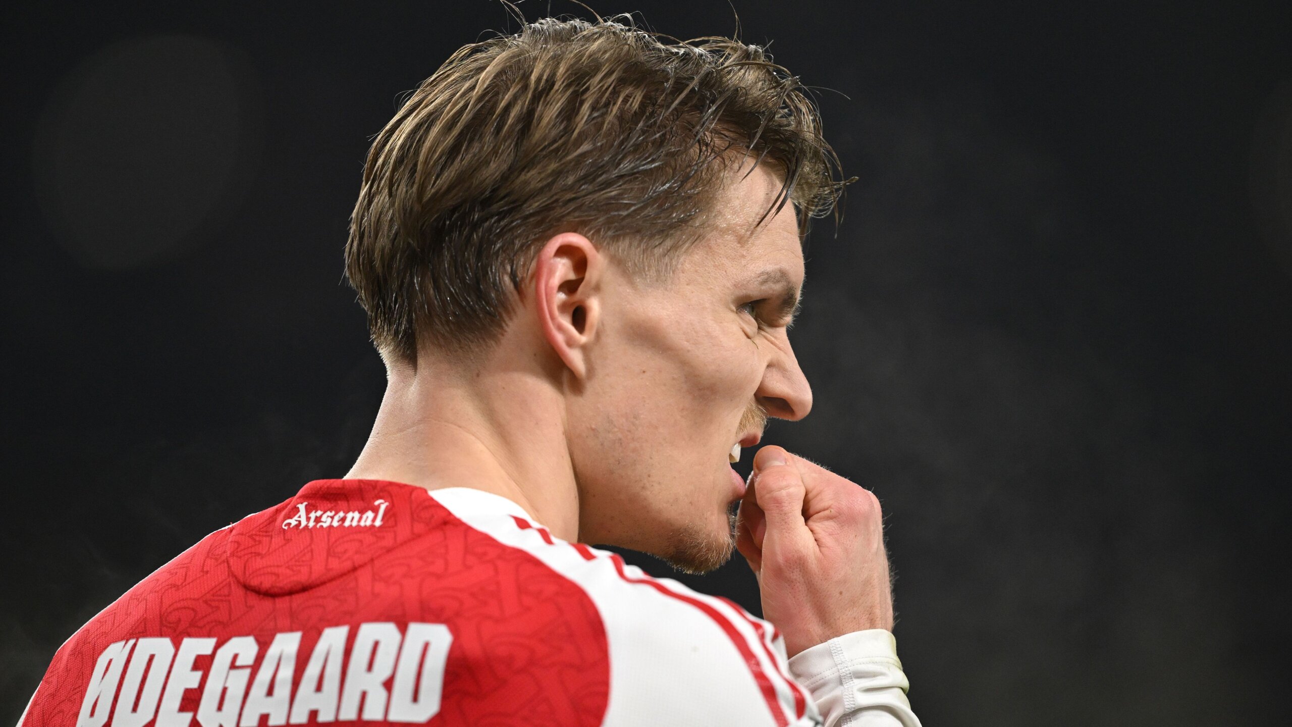 Odegaard Injury Blow Hits Arsenal Ahead of Chelsea Semi-Final 1 GettyImages 2258855042 scaled
