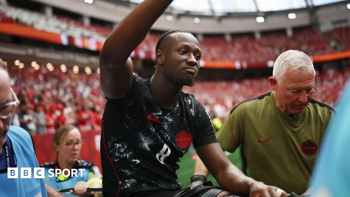 Canada midfielder Ismael Kone thanks supporters after broken leg surgery 1 51826660 6c06 11f1 8546 8f19e4fe30f4